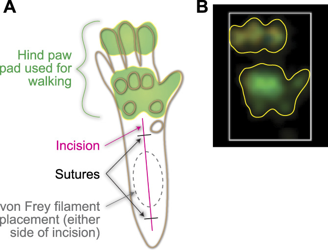 Opioids alter paw placement during walking, confounding assessment of analgesic efficacy in a postsurgical pain model in mice.