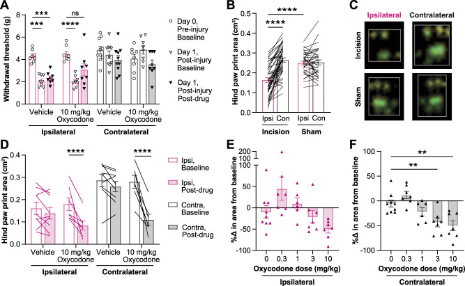 Opioids alter paw placement during walking, confounding assessment of analgesic efficacy in a postsurgical pain model in mice.