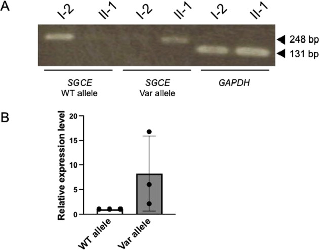 A Japanese family with dystonia due to a pathogenic variant in SGCE.