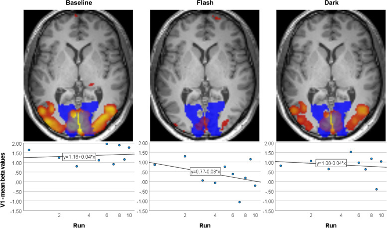 Avoid or seek light - a randomized crossover fMRI study investigating opposing treatment strategies for photophobia in migraine.