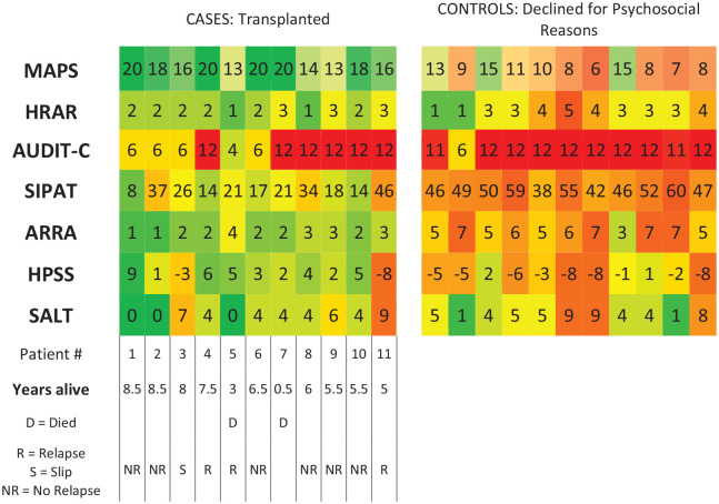 An Assessment of the Psychosocial Evaluation for Early Liver Transplantation in Patients With Acute Alcoholic Hepatitis in the Context of Alcohol Use Disorder, a Case-Control Study.