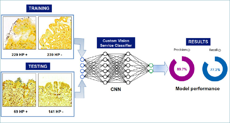 Use of digital pathology and artificial intelligence for the diagnosis of Helicobacter pylori in gastric biopsies.