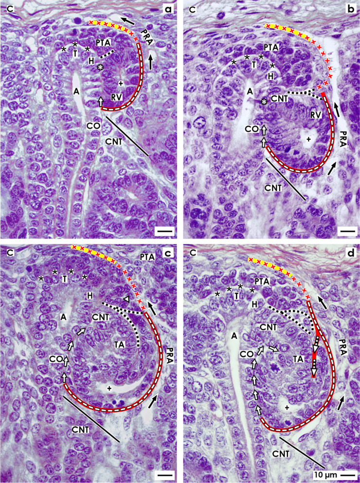 The interstitium at the developing nephron in the fetal kidney during advanced pregnancy - a microanatomical inventory.