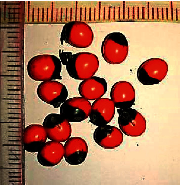 A Case of Poisoning with <i>Abrus precatarius</i> Complicated with Bilateral Basal Ganglia Haemorrhage.