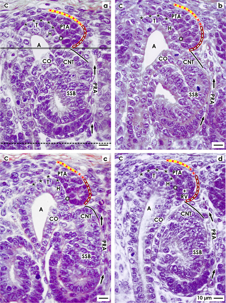 The interstitium at the developing nephron in the fetal kidney during advanced pregnancy - a microanatomical inventory.