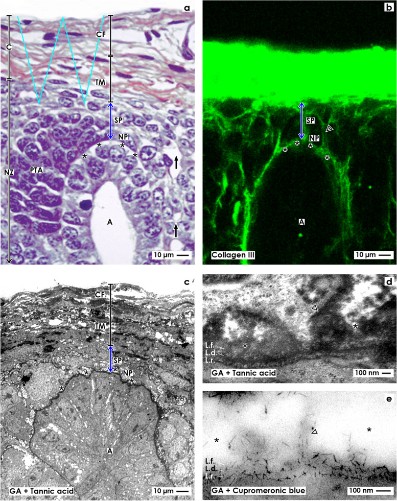 The interstitium at the developing nephron in the fetal kidney during advanced pregnancy - a microanatomical inventory.