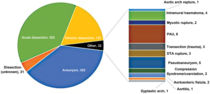 Frozen Elephant Trunk Sizing: A 30,000-Feet Perspective with Thoraflex Hybrid Stent Graft.