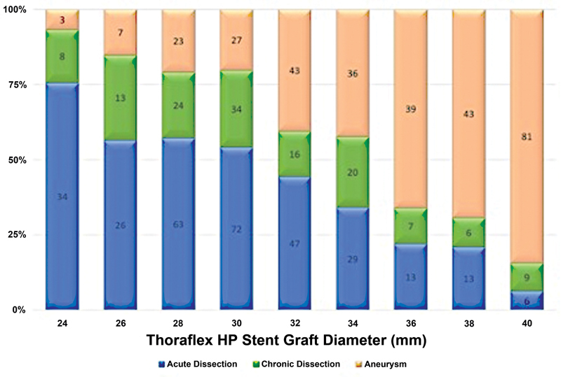 Frozen Elephant Trunk Sizing: A 30,000-Feet Perspective with Thoraflex Hybrid Stent Graft.