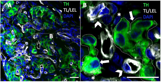 Cellular basis of learning and memory in the carotid body.