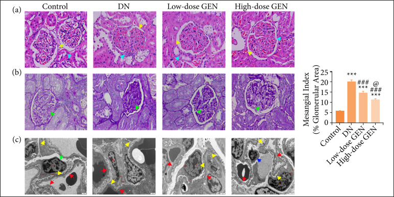 Genistein improves mitochondrial function and inflammatory in rats with diabetic nephropathy via inhibiting MAPK/NF-κB pathway.