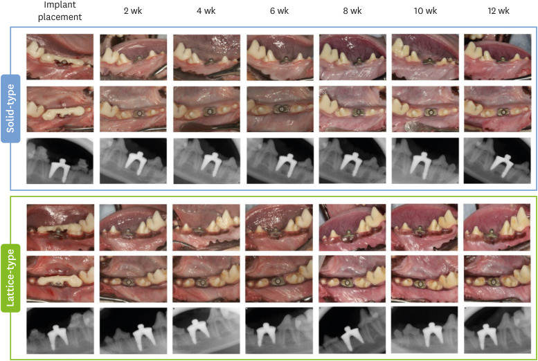 Impact of lattice versus solid structure of 3D-printed multiroot dental implants using Ti-6Al-4V: a preclinical pilot study.
