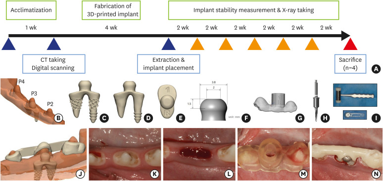 Impact of lattice versus solid structure of 3D-printed multiroot dental implants using Ti-6Al-4V: a preclinical pilot study.