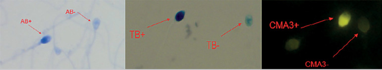 The effects of morphine abuse on sperm parameters, chromatin integrity and apoptosis in men.