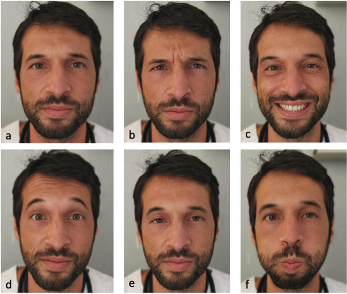 Patients with post-COVID-19 vaccination facial palsy: To boost or not to boost?