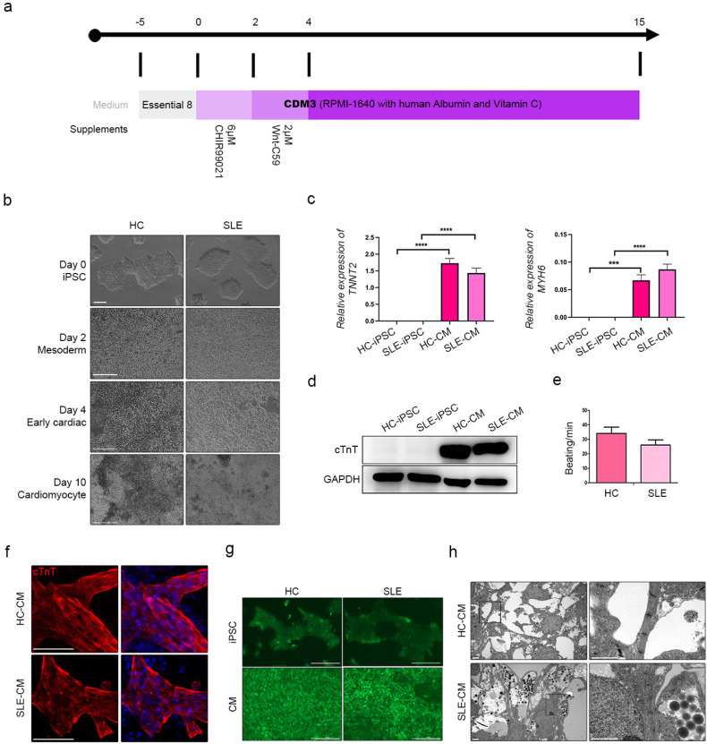 Lupus Heart Disease Modeling with Combination of Induced Pluripotent Stem Cell-Derived Cardiomyocytes and Lupus Patient Serum.