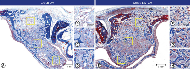 Effect of the size of the bony access window and the collagen barrier over the window in sinus floor elevation: a preclinical investigation in a rabbit sinus model.