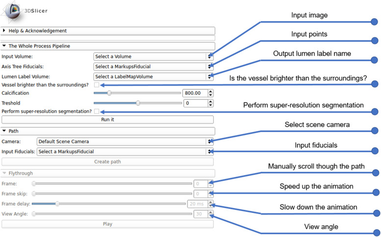 Open-source algorithm and software for computed tomography-based virtual pancreatoscopy and other applications.