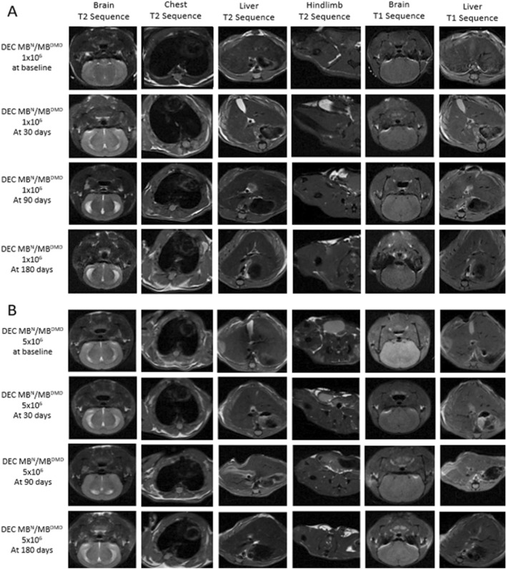 Long-Term Biodistribution and Safety of Human Dystrophin Expressing Chimeric Cell Therapy After Systemic-Intraosseous Administration to Duchenne Muscular Dystrophy Model