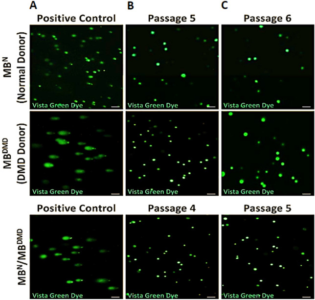 Long-Term Biodistribution and Safety of Human Dystrophin Expressing Chimeric Cell Therapy After Systemic-Intraosseous Administration to Duchenne Muscular Dystrophy Model