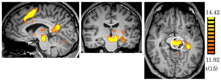 Involvement of the intrinsic functional network of the red nucleus in complex behavioral processing.