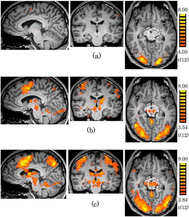 Involvement of the intrinsic functional network of the red nucleus in complex behavioral processing.