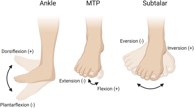 The impact of stance during heel raises on the hybrid ultimate lifting kit (HULK) device: A future microgravity exercise machine.