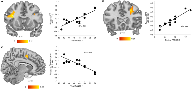 Functional neurodevelopment of working memory in early-onset schizophrenia: A longitudinal FMRI study