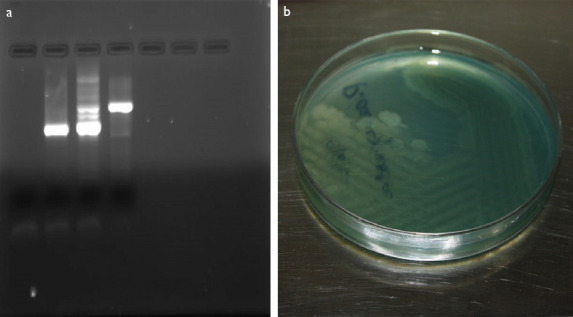 Unilateral Endogenous Bacterial Endophthalmitis Post-Coronavirus Disease-19 in an Healthy Asian Indian Male.