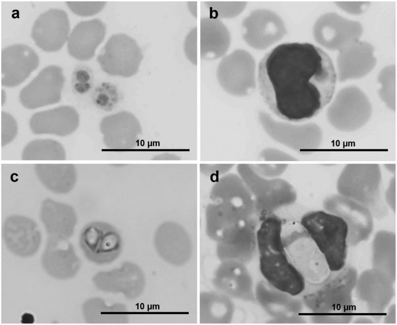 Multiple blood pathogen infections in apparently healthy sheltered dogs in southern Thailand.