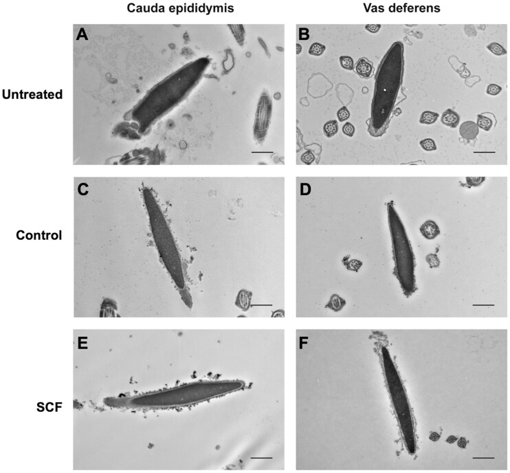 Sperm degradation after vasectomy follows a sperm chromatin fragmentation-dependent mechanism causing DNA breaks in the toroid linker regions.