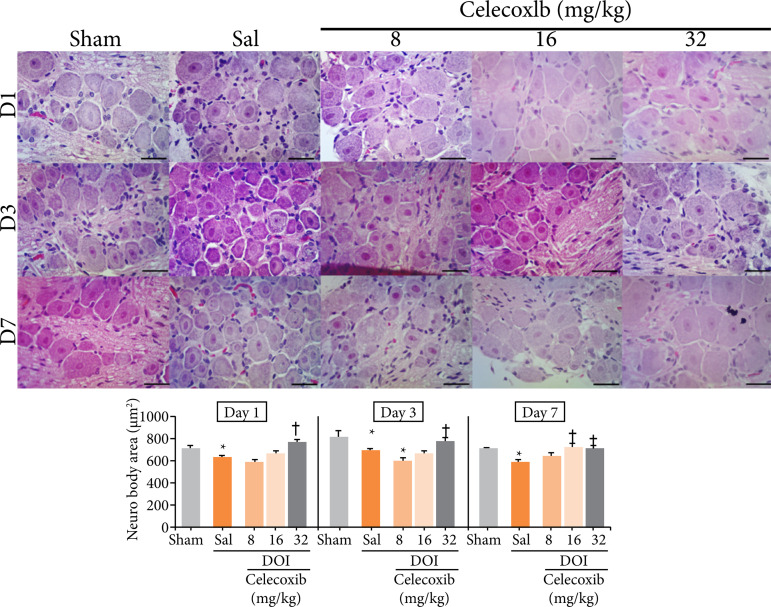 Celecoxib in the treatment of orofacial pain and discomfort in rats subjected to a dental occlusal interference model.