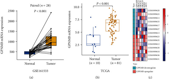 Prognostic Value of GPNMB, EGFR, p-PI3K, and Ki-67 in Patients with Esophageal Squamous Cell Carcinoma.