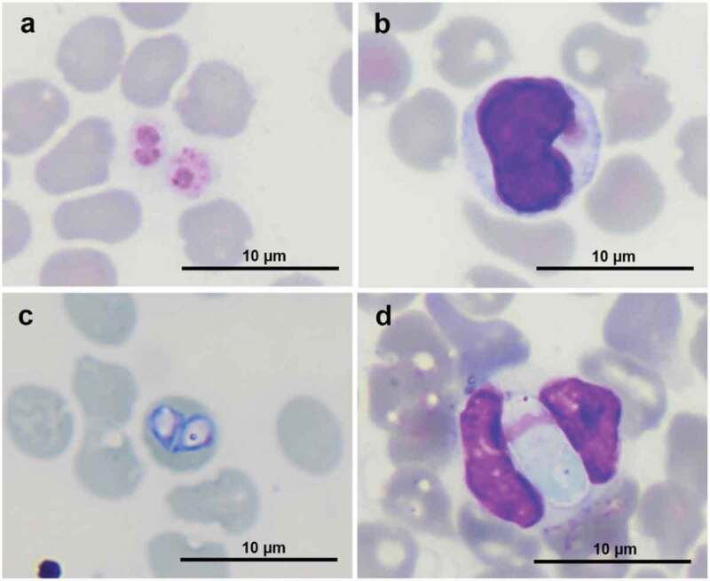 Multiple blood pathogen infections in apparently healthy sheltered dogs in southern Thailand.