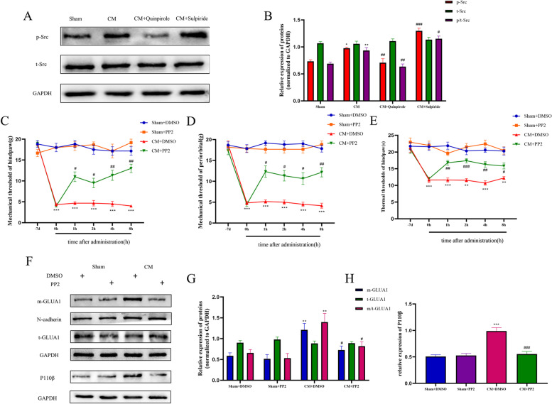 Dopamine receptor D2 regulates GLUA1-containing AMPA receptor trafficking and central sensitization through the PI3K signaling pathway in a male rat model of chronic migraine.