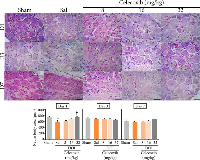 Celecoxib in the treatment of orofacial pain and discomfort in rats subjected to a dental occlusal interference model.