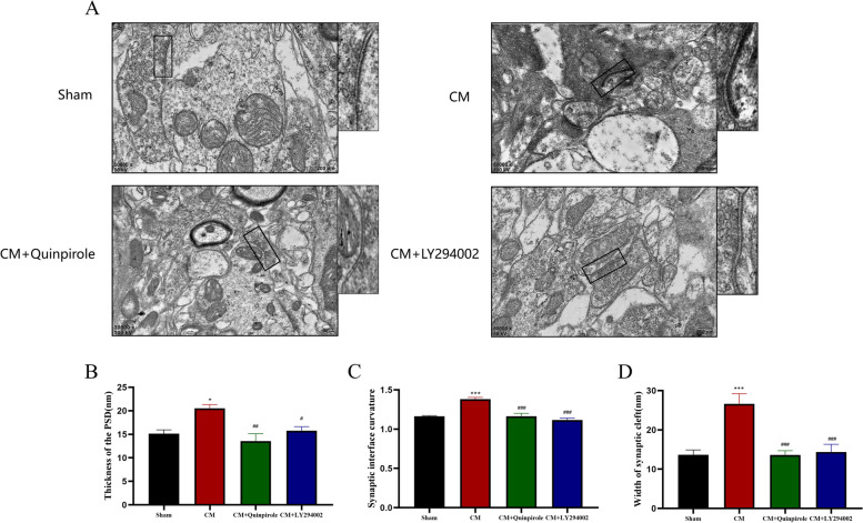 Dopamine receptor D2 regulates GLUA1-containing AMPA receptor trafficking and central sensitization through the PI3K signaling pathway in a male rat model of chronic migraine.