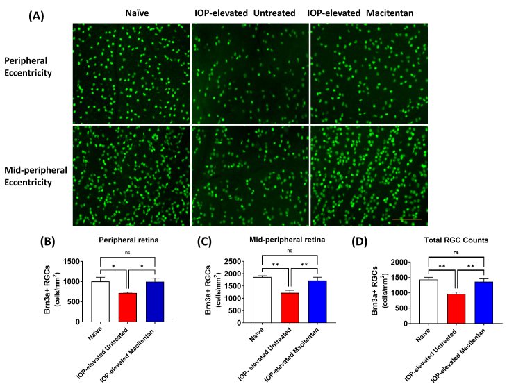 Oral administration of a dual ET<sub>A</sub>/ET<sub>B</sub> receptor antagonist promotes neuroprotection in a rodent model of glaucoma.