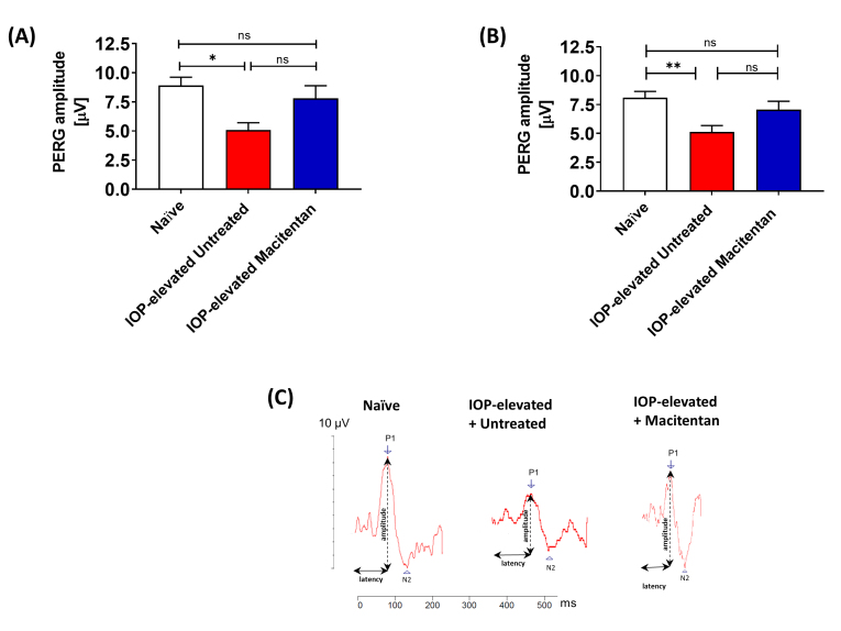 Oral administration of a dual ET<sub>A</sub>/ET<sub>B</sub> receptor antagonist promotes neuroprotection in a rodent model of glaucoma.