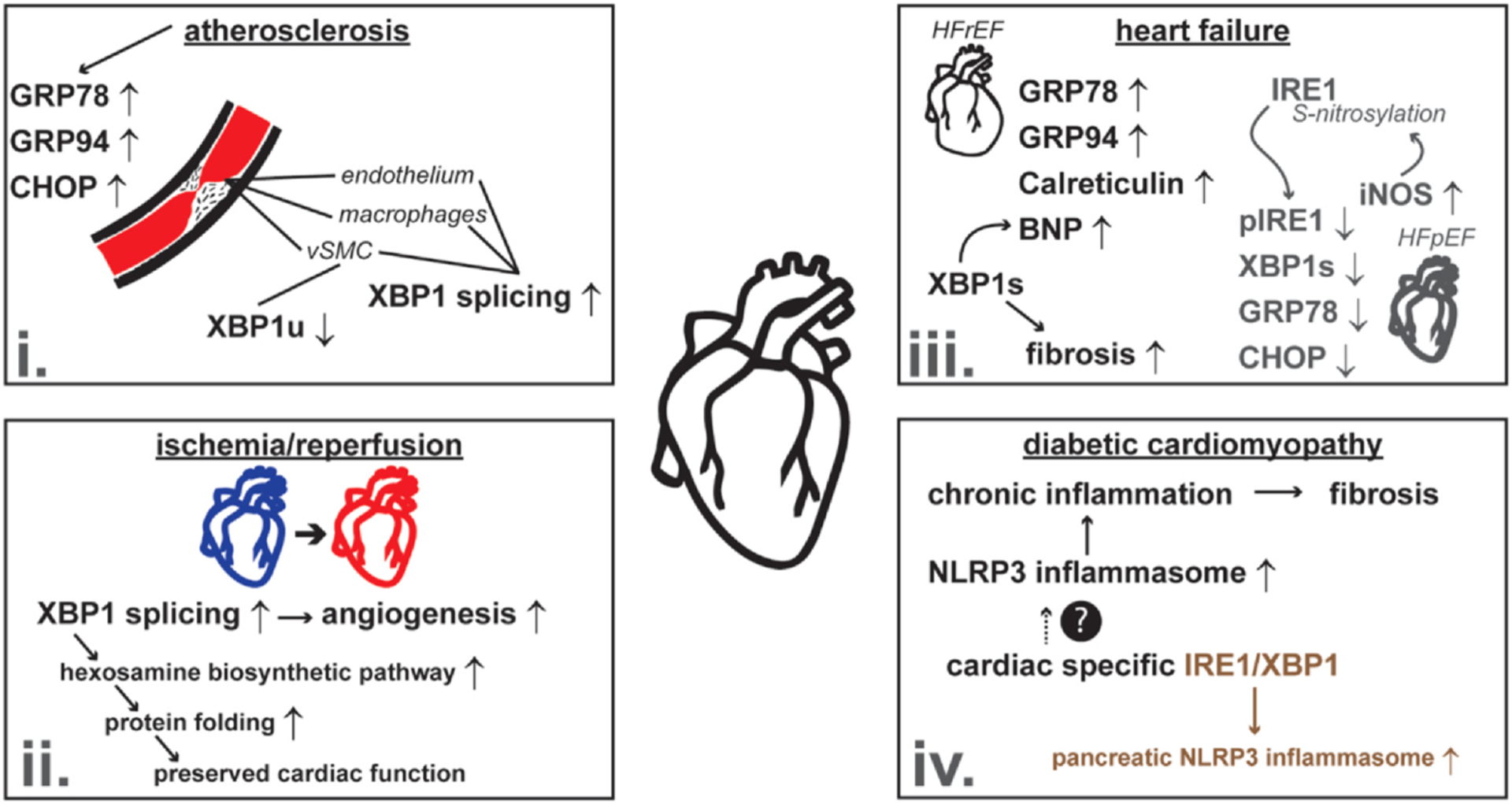 IRE1/XBP1 and endoplasmic reticulum signaling — from basic to translational research for cardiovascular disease