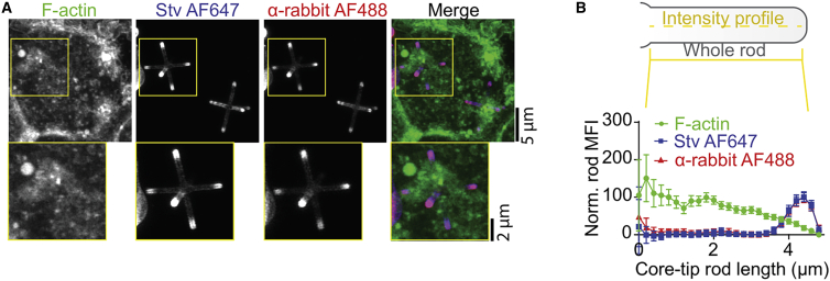 Irregular particle morphology and membrane rupture facilitate ion gradients in the lumen of phagosomes.