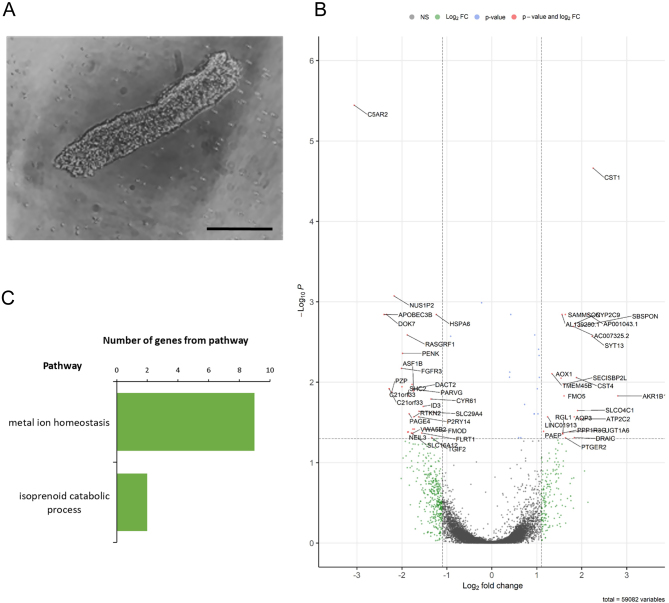 Endometrial gland specific progestagen-associated endometrial protein and cilia gene splicing changes in recurrent pregnancy loss.