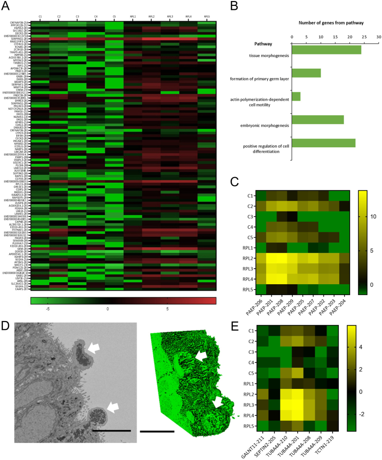 Endometrial gland specific progestagen-associated endometrial protein and cilia gene splicing changes in recurrent pregnancy loss.