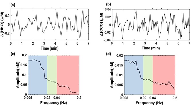 Prefrontal cortical connectivity and coupling of infraslow oscillation in the resting human brain: a 2-channel broadband NIRS study.