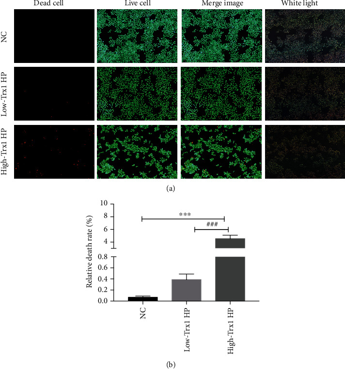 Helicobacter pylori Thioredoxin1 May Play a Highly Pathogenic Role via the IL6/STAT3 Pathway.
