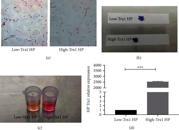 Helicobacter pylori Thioredoxin1 May Play a Highly Pathogenic Role via the IL6/STAT3 Pathway.