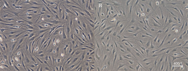 Long noncoding and micro-RNA expression in a model of articular chondrocyte degeneration induced by stromal cell-derived factor-1.