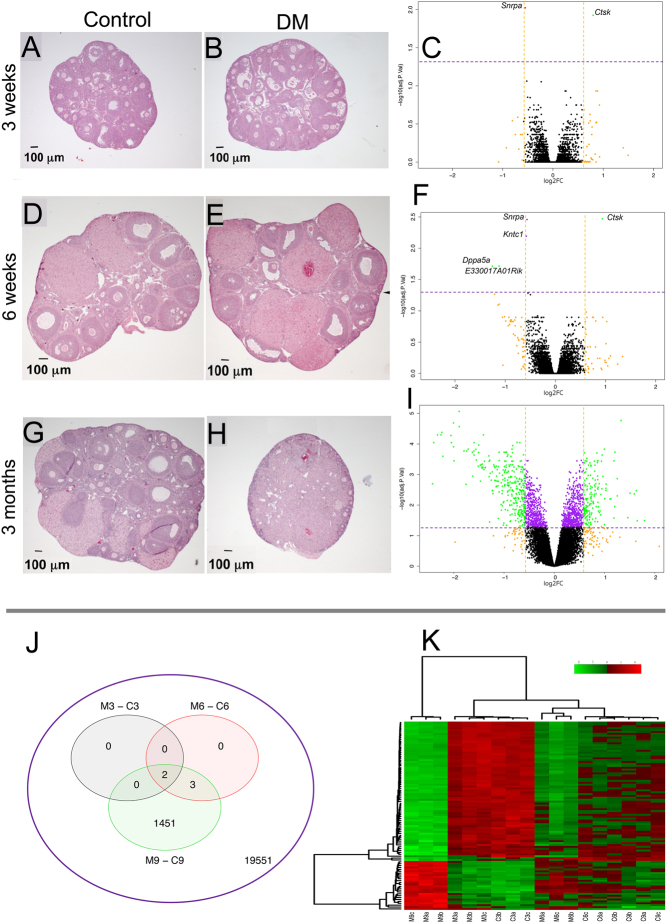 Rapid ovarian transcript changes during the onset of premature ovarian insufficiency.