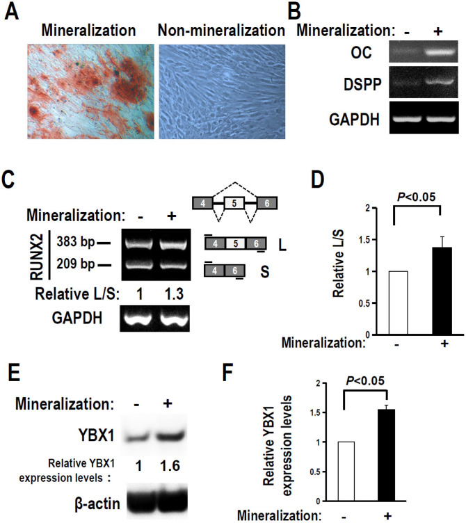 YBX1 Promotes the Inclusion of RUNX2 Alternative Exon 5 in Dental Pulp Stem Cells.