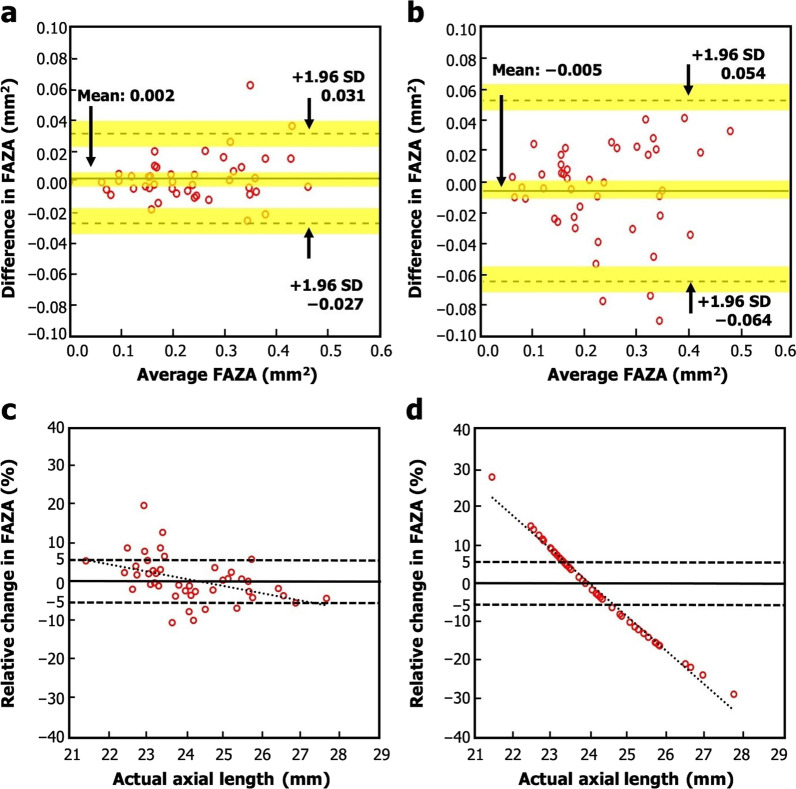 Correcting magnification error in foveal avascular zone area measurements of optical coherence tomography angiography images with estimated axial length.