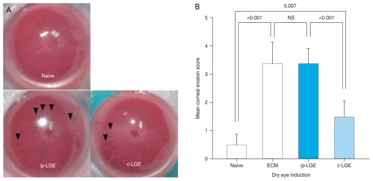 Impact of Lacrimal Gland Extraction on the Contralateral Eye in an Animal Model for Dry Eye Disease.